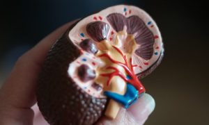 Best Hospital In Bengaluru For Kidney Stone Treatment.jpg